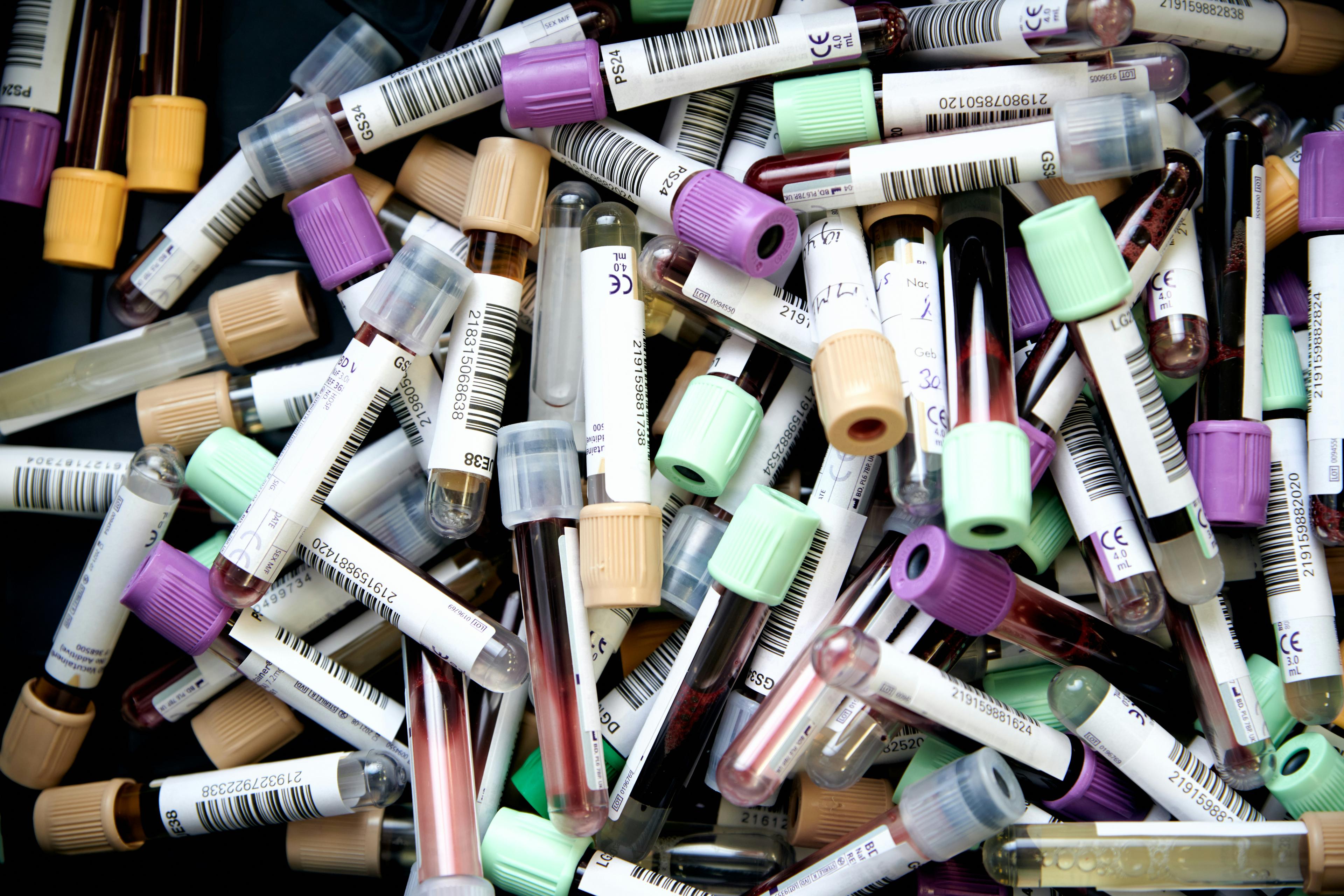 Immagine articolo Esami del Sangue per Sportivi